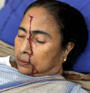 बंगाल की सीएम ममता बनर्जी हादसे का शिकार, सिर पर लगी चोट